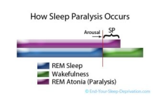 ShutEye sleep paralysis cause solution how to avoid