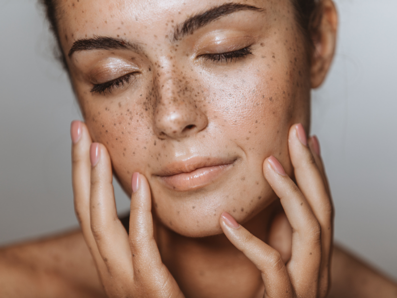 factors that can affect your skin are certain skin conditions, eczema or acne