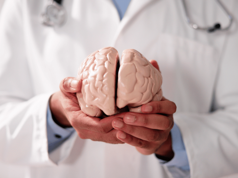 doctor holding a brain representing cognitive function