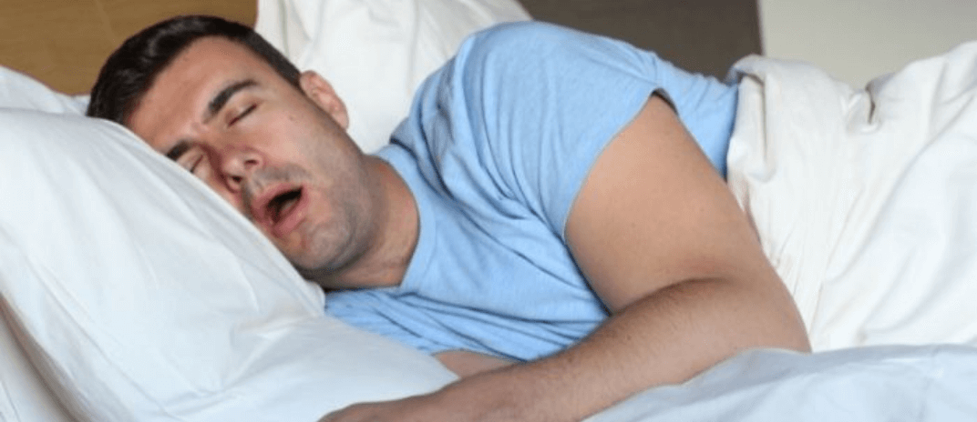 The 5 Best Stop Snoring Devices That Work