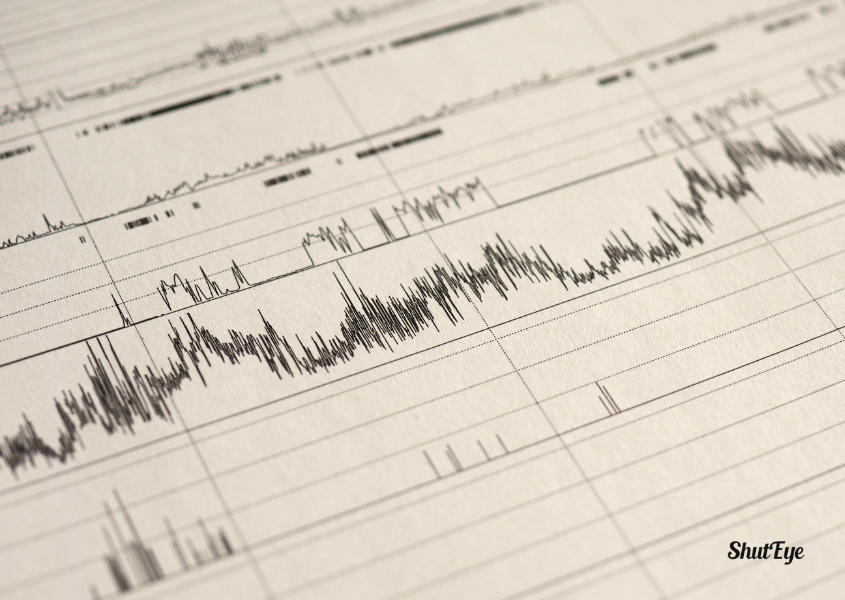 polysomnogram
narcolepsy diagnosis factors